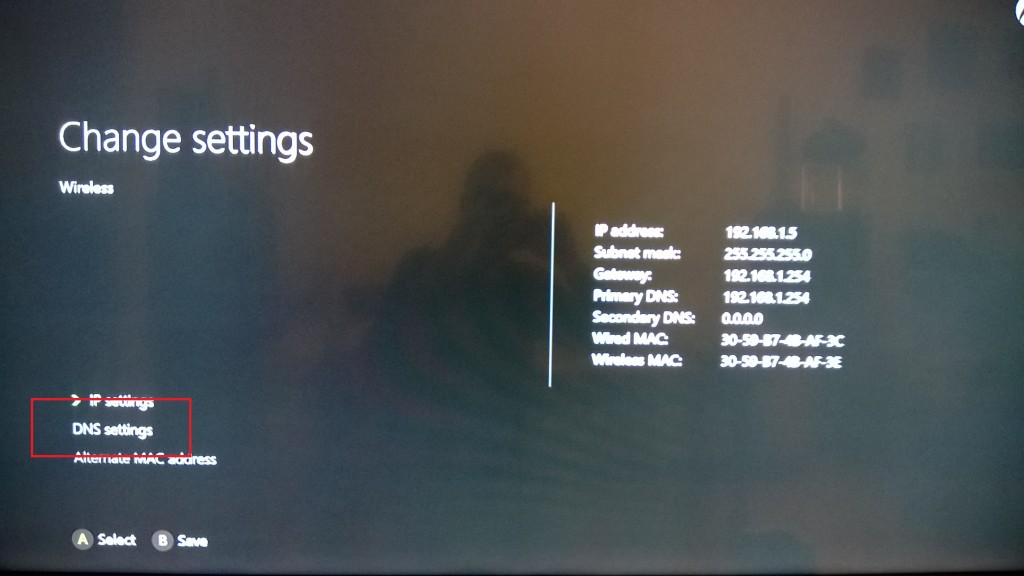 Xbox One SMartDNS setup