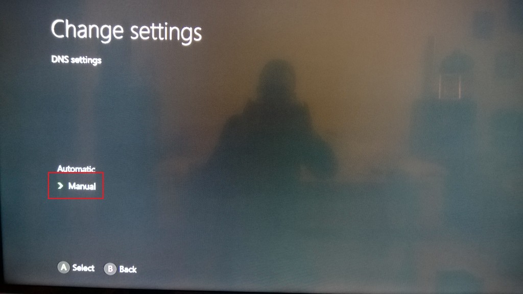 Xbox One Smart DN setup